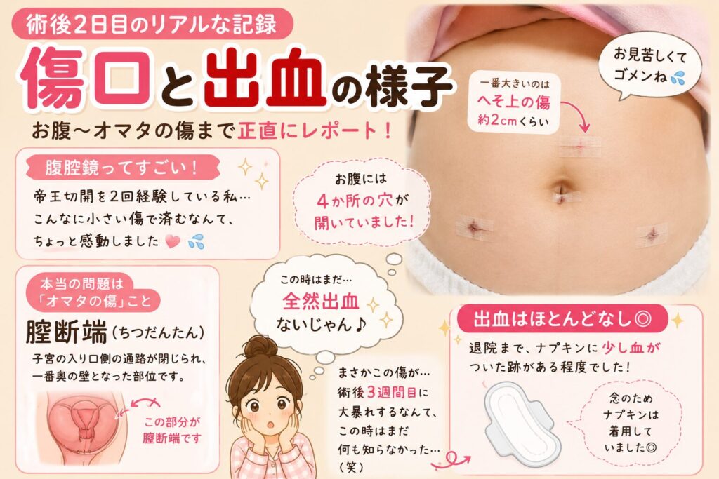 術後2日目のリアルな記録「傷口と出血の様子」お腹〜オマタの傷まで正直にレポート！の画像